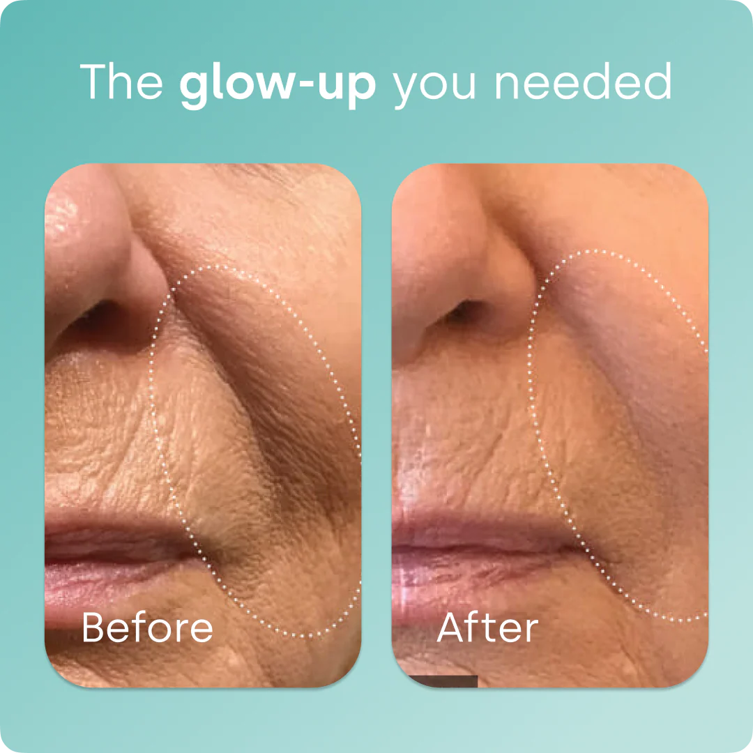 Collagen Generator - Liquid Capsules