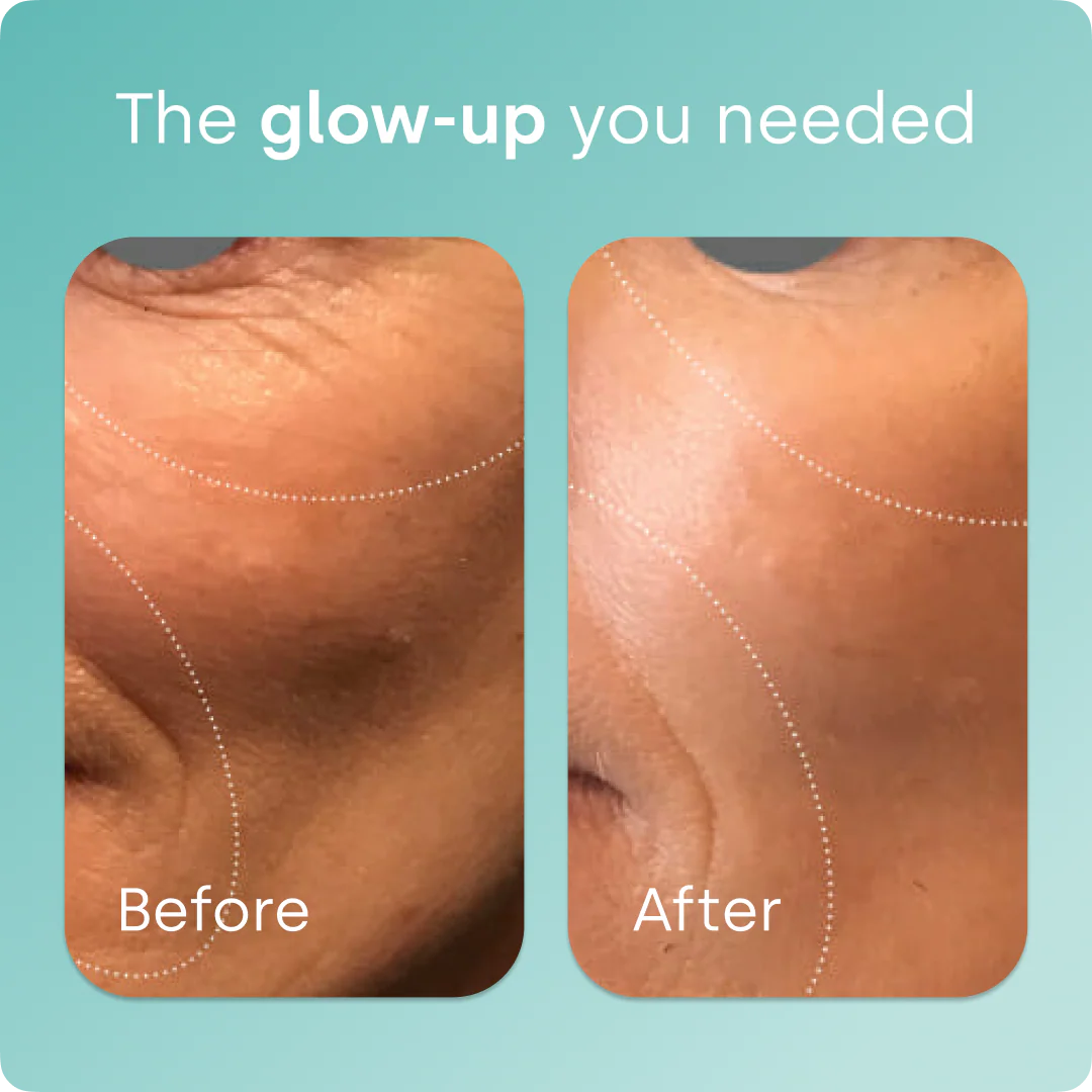 Collagen Generator - Liquid Capsules