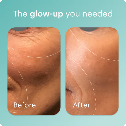 Collagen Generator - Liquid Capsules